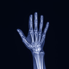 the X-ray shows a part of the human skeleton, the hand