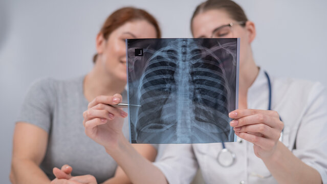 The doctor consults a caucasian woman and comments on the x-ray of the lungs. 