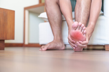 man having barefoot pain due to Plantar fasciitis and  bunion toes or blister due to wearing narrow shoes and waking or running longtime. Health and medical concept - obrazy, fototapety, plakaty