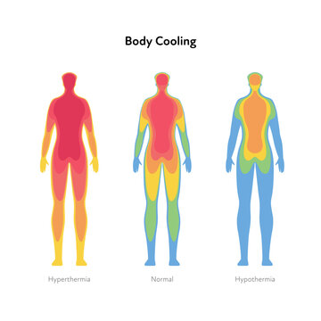 Hyperthermia and hypothermia health care infographic. Vector flat healthcare illustration. Body cooling infrared heat map isolated on white background.