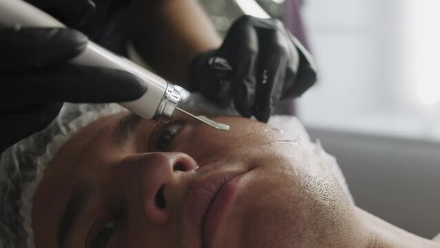 Beauty treatments - hand of cosmetologist cleans the face of a man using ultrasonic scrubber