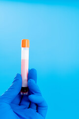 Hand holing a blood test tube with blank label