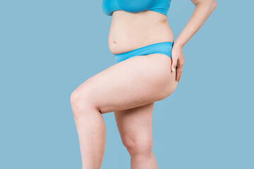 Overweight woman, fat thighs and buttocks, obesity female legs with cellulite
