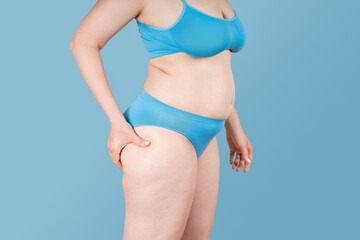 Overweight woman, fat thighs and buttocks, obesity female legs with cellulite