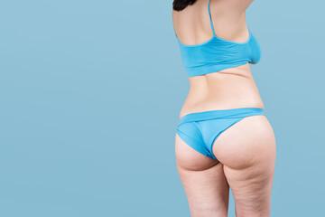 Overweight thigh, woman with fat hips and buttocks, obesity female body with cellulite on blue...