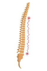 Spinal deformity. Symbol of spine curvatures or unhealthy backbones. Human spine anatomy, curved spine. Diagram with marked section. Body posture defect