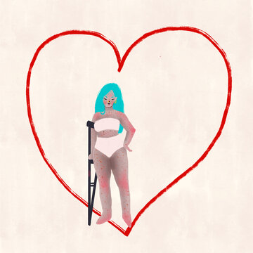Mujer con muletas posando en ropa interior dentro de un coraz&oacute;n