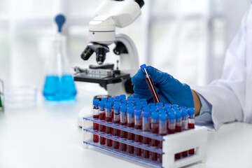 A gloved Asian woman holding a test blood vessel in a research lab takes a blood sample tube from a...