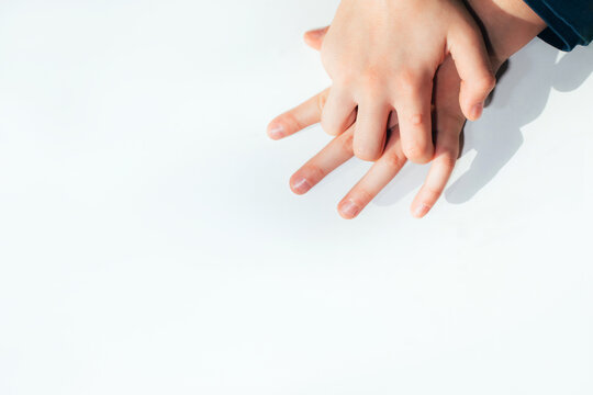Children's hand with a wart on a white background. Papilomavirus. View from above