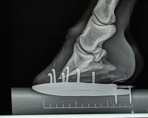 close up x-ray of horses lower front leg showing horse show and nails as well as hoof foot ankle...