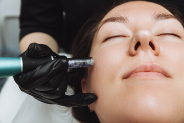 Cosmetic mesotherapy for facial rejuvenation. Cosmetic procedure of microneedling. The...