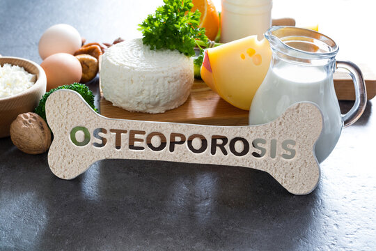Osteoporosis concept. Food products recommended for osteoporosis, diary and non-diary products rich in calcium
