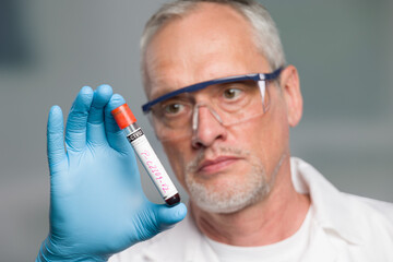 doctor or scientist is handling a blood test tube in front of a lab room