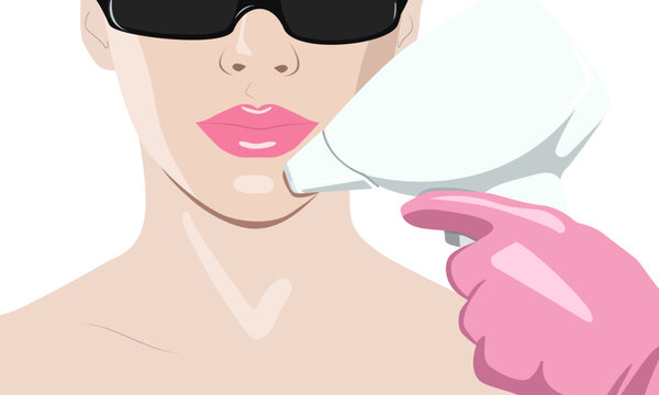 Illustration. Epilation hair removal procedure on a woman’s face. Beautician doing laser rejuvenation in a beauty salon. Removing unwanted body hair. 