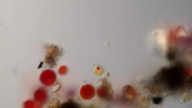 Haematococcus pluvialis under a microscope. This species is well known for its high content of the strong antioxidant astaxanthin, which is important in aquaculture, healthcare and cosmetics.