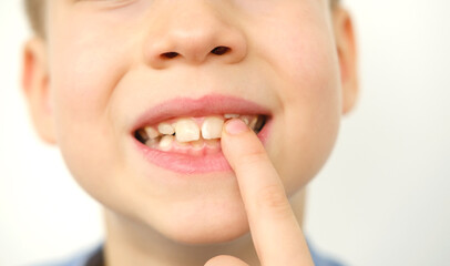 close-up hand of child, boy of 9 years old points new tooth fang in mouth with finger, concept of...