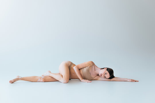full length of barefoot and young woman with vitiligo lying in beige lingerie on grey background.