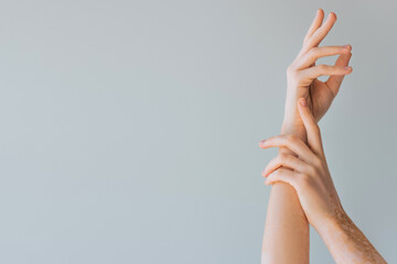 Fototapeta na wymiar cropped view of elegant female hands with vitiligo isolated on grey.