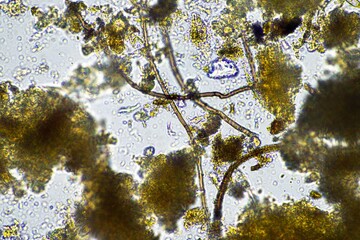 soil fungi and microorganisms in a soil and compost sample