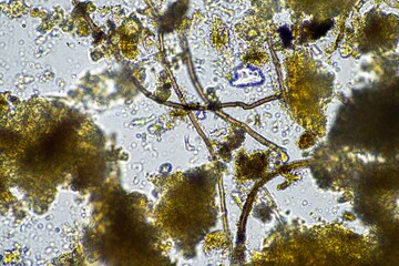 soil fungi and microorganisms in a soil and compost sample