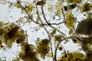 soil fungi and microorganisms in a soil and compost sample