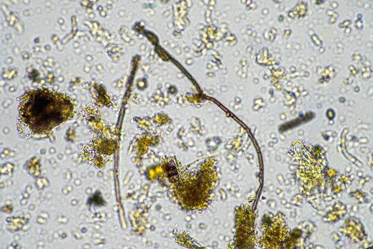 soil fungi and microorganisms in a soil and compost sample