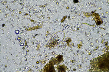 soil fungi and microorganisms in a soil and compost sample