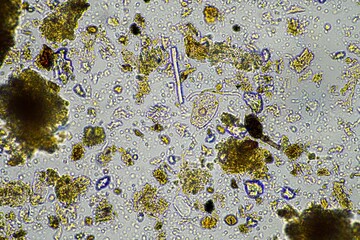 soil fungi and microorganisms in a soil and compost sample