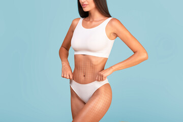 Obraz premium Body Aesthetics. Young Slim Female In Underwear With Lifting Mesh On Skin