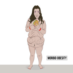 Morbid obesity is excessive weight that the person suffers causes health problems and reduces their life expectancy.