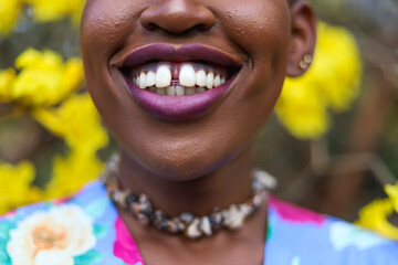 Diastema