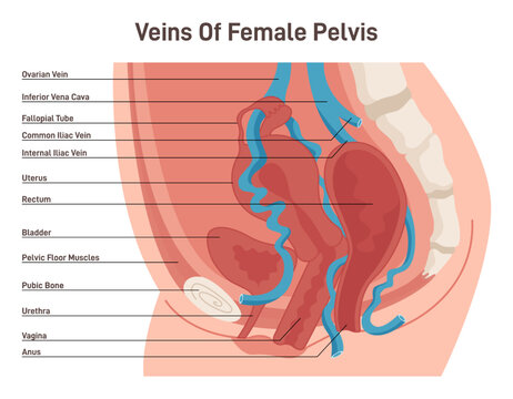 Female reproductive system arteries and veins. Healthy human uterus