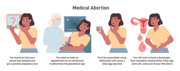 Medical abortion procedure and course of the process. Doctor prescribe - obrazy, fototapety, plakaty