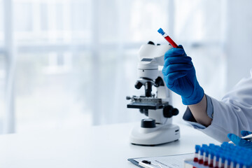 Lab assistant, a medical scientist, a chemistry researcher holds a glass tube through the blood...