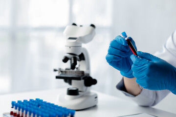 Lab assistant, a medical scientist, a chemistry researcher holds a glass tube through the blood sample, does a chemical experiment and examines a patient's blood sample. Medicine and research concept.