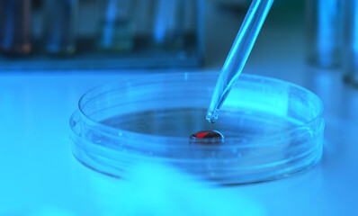 Close up shot of Petri dish with pipette.