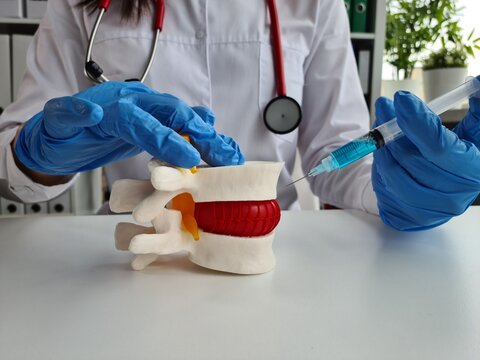 Neurologist doctor holds imitation of the spine with intervertebral hernia