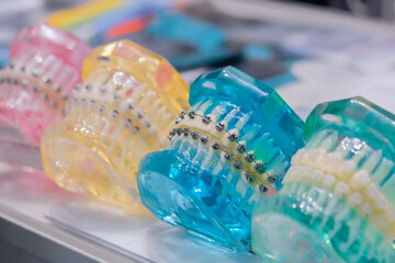 Transparent colorful human jaws with orthodontic bracket, metal and ceramic braces. Stomatology, education, medicine concept