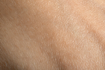 Fototapeta premium Closeup view of dry human skin as background
