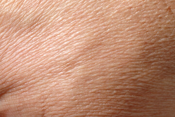 Fototapeta premium Closeup view of dry human skin as background