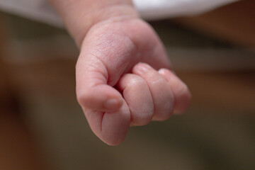 It is a dermatitis small warty bumps appear on the skin in child.