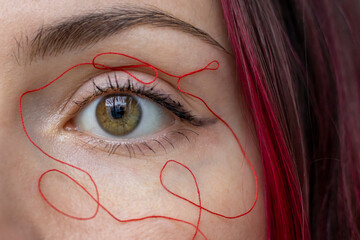 Close-up photo of the eye with red thread around the eyes. The concept of vein and vascular health, a reference to vascular asterisks. spider vein