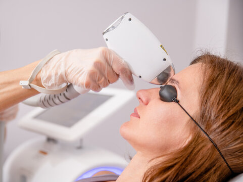 Professional beautician removes hair on the face of an young woman using a laser. Unibrow removal, laser procedure at clinic