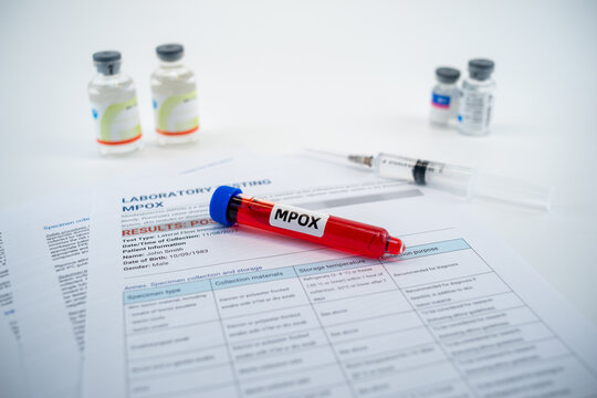 Blood collection tubes monkeypox test positive results,WHO to rename monkeypox as ‘MPOX’ - Powered by Adobe