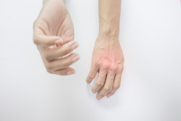 Human hand with muscle problems, inflammation, pain and swelling.