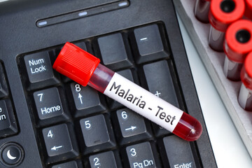 Malaria test to look for abnormalities from blood