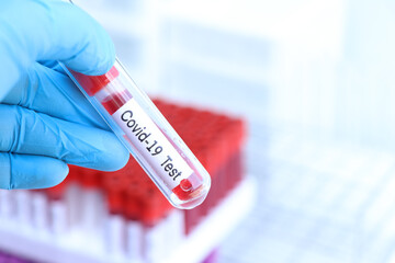 Covid-19 test to look for abnormalities from blood