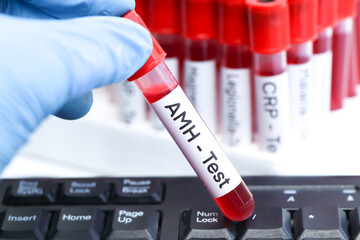 Fototapeta premium AMH test to look for abnormalities from blood