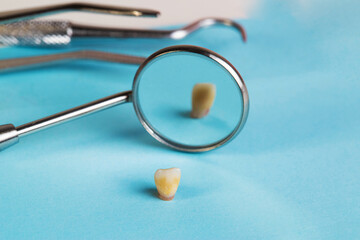 dental mirror, dental instruments and milk baby tooth on a blue background. The concept of pediatric dental surgery. Removal of milk teeth. Copy space for text