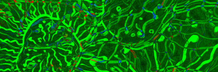 Bacteria Macro. Black Virus Rabies. Olive Flu Bacteria. Antibody Response. Lime Cells Human. Mint Attacking Cancer. Cancer Gene Therapy. Flu Character.